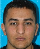 جراحی زیبایی - بعداز عمل