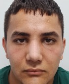 جراحی زیبایی - قبلاز عمل