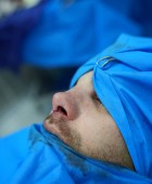 جراحی زیبایی - قبلاز عمل