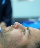 جراحی زیبایی - بعداز عمل