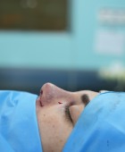 جراحی بینی - قبلاز عمل