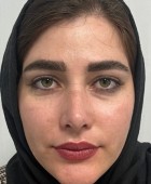 جراحی زیبایی - قبلاز عمل