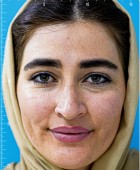 جراحی زیبایی - بعداز عمل