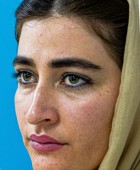 جراحی زیبایی - بعداز عمل