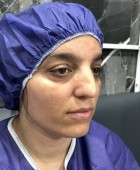 جراحی زیبایی بینی - بعداز عمل