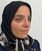 جراحی زیبایی بینی - قبلاز عمل